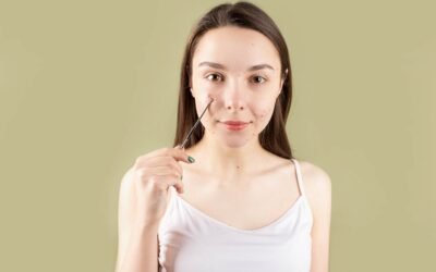 What Causes Acne? Understanding the Science Behind Breakouts